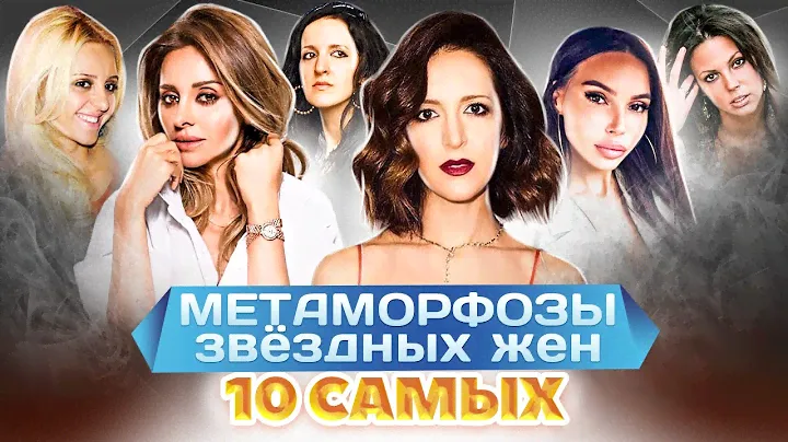 Жены звезд до и после пластики | Самойлова, Ревва, Галустян, Шнурова, Брухунова